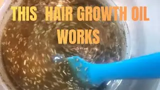 Best hair growth oil 