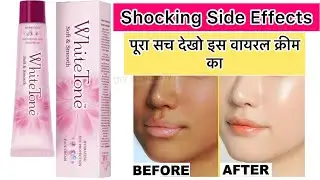 Shocking Side effects | Whitetone Face Cream Review | must watch before use | DIY & Beauty