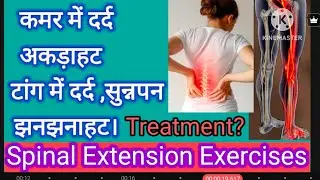 Spinal Extension Exercises to Treat Discal Problems Like  Slip Disc , Disc Herniation,, Disc Bulge