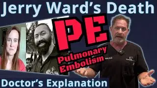 Bodybuilder Jerry Ward's Death: Pulmonary Embolism - Doctor's Explanation