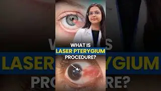 Laser Pterygium Surgery Explained | Safe, Stitch-Free & Fast Recovery