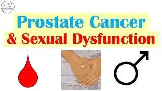 5 Sexual Changes Linked to Prostate Cancer Every Man Should Know