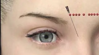 how to operate pdo thread on each treatment area