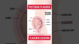 POSTERIOR PLACENTA 😊#shorts #shortfeed #ytshorts #trending #viral #placenta