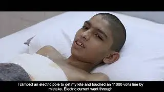 Burns Centre Documentary by Mr. Nadir Aziz (Intern)