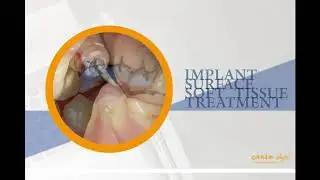 CEREC Asia Workshop【CEREC Insight Intermediate】