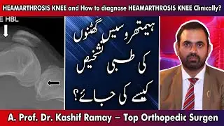 52- HEAMARTHROSIS KNEE and How to diagnose HEAMARTHROSIS KNEE Clinically? | Dr. Kashif Ramay