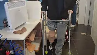 My new prosthetic leg