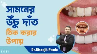 How do we fix Buck Teeth Know More at Dactar Babu | Best Dental Doctors in Kolkata