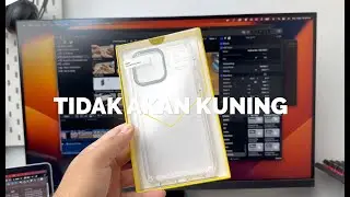 Korang confirm tak percaya casing ni takkan kuning?