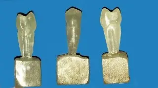 Carving of maxillary second premolar