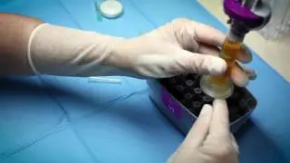T&eacute;cnica ENDORET en Institut Oft&agrave;lmic de Mallorca