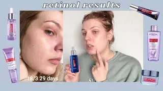 Over 30 Days Of Retinol, L'Oréal Revitalift Skincare Review