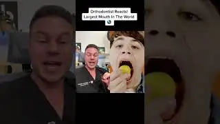 LARGEST MOUTH IN THE WORLD! Orthodontist Reacts! #shorts