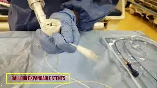 Preparation of Vascular Stents