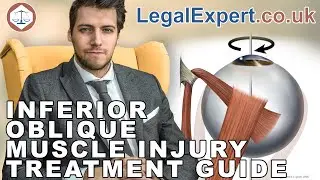 Inferior Oblique Muscle Injury Treatment Guide ( 2019 ) UK