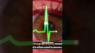 XLRP Diagnosis  4 Key Methods Explained