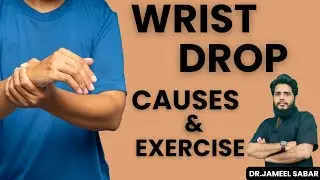 Wrist Drop | Radial Nerve Injury Explained & Best Exercises
