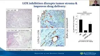 Hepatocellular carcinoma ‐ Dr Paul Burchard