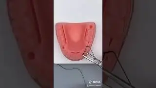 Sutures for an Incision in the Mouth