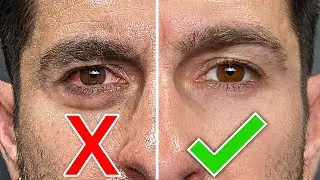 MORE ATTRACTIVE EYES in 3 DAYS! (6 Tricks to Fix Dark Circles, Eye Bags, Red Eyes FAST)