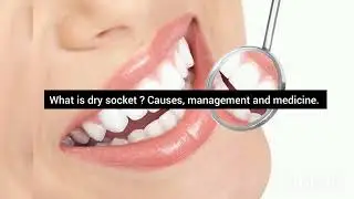 JPSC DENTAL SURGEON INTERVIEW QUESTIONS part 1