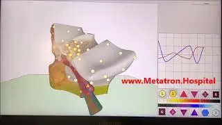 Ear Health and Ear Care the best health device for personal or business use - Metatron Remote