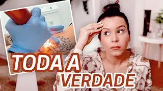 PORQUE DECIDI REMOVER A MINHA TATUAGEM | Inês Rochinha