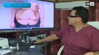 صحتنا جميع: كيفيه التخلص من ترهلات البطن  - الأحد 7 فبراير