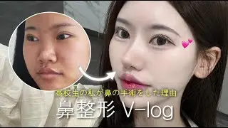 [整形密着Vlog]ブサイクな鼻改善、高校生で鼻整形しました｜リアルな経過と変化（派手鼻Vlog）🥰