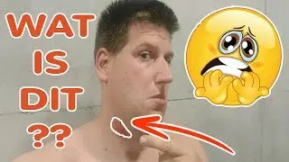 VREEMDE KNOBBEL IN MIJN NEK!! KOETLIFE VLOG