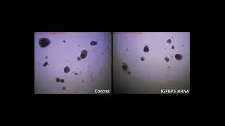 Application of EzScope Live Cell Imaging System &ndash; Human Embryonic Lung Organoids│Blue-Ray Biotech