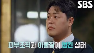 수술 당시 이물질만 제거할 수 없었던 ‘선풍기 아줌마’ 한혜경 씨의 피부 상태