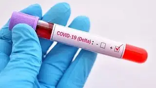 Variante Delta: estudo comprova efic&aacute;cia das vacinas da Pfizer e AstraZeneca