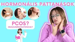 Hormonális pattanások kezelése