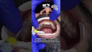 Get up to $3,000 coverage for treatment worth $6,000&ndash;$8,000! | Check description!