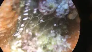 Botrylloides leachii