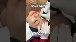 TREATMENT SUPER NYEGERIN ? JEET PEEL / #oxygenspray #klinikkecantikan #pesonaayu #glowingskin