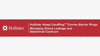 Hollister Adapt CeraRing&trade; Convex Barrier Rings: Managing Stoma Leakage and Abdominal Contours