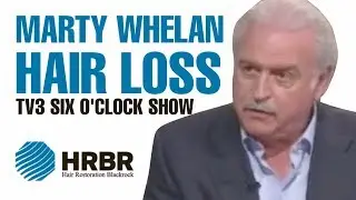Marty Whelan discusses his hair transplant on TV3 - May 2018