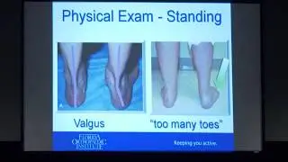 Dr. Evan Loewy Foot and Ankle Presentation  - Florida Orthopaedic Institute