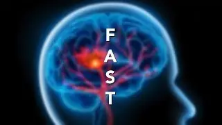Identifying Signs and Symptoms of Stroke - FAST