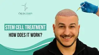 STEM CELL TREATMENT: HOW DOES IT WORK FOR HAIR REGROWTH ?