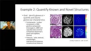 CureGN Pathology DPR Training November 2021
