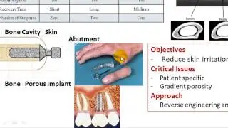 LENS- Optomec and Integrated Implants