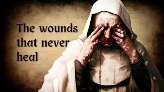 The Bizarre Phenomenon of Stigmata In The Catholic Church