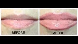 Fuller Sexy Lips without plastic surgery
