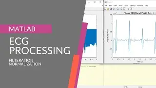 ECG Filtration and Normalization in MATLAB | MATLAB Digital Signal Processing
