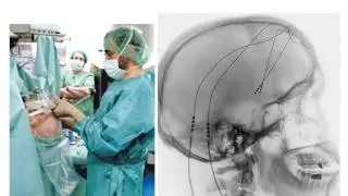 Repairing and Treating Damaged or Dysfunctional Brains - Professor Keith Kendrick