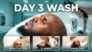 HAIR TRANSPLANT WASHING - 3 DAYS LATER